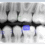 VisiQuick 4.9.0 – Fully native integration Nanok AI, Intra Oral scanner Shining 3D and 3D Slicer added as a 3D viewer
