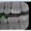 VisiQuick 4.9.0 – Fully native integration Nanok AI, Intra Oral scanner Shining 3D and 3D Slicer added as a 3D viewer